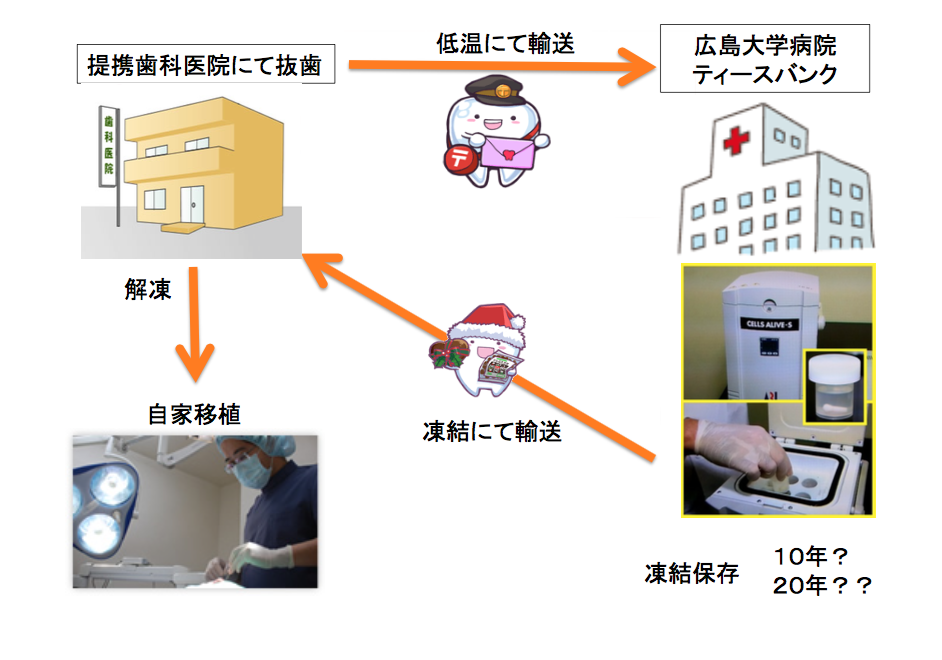 歯の銀行